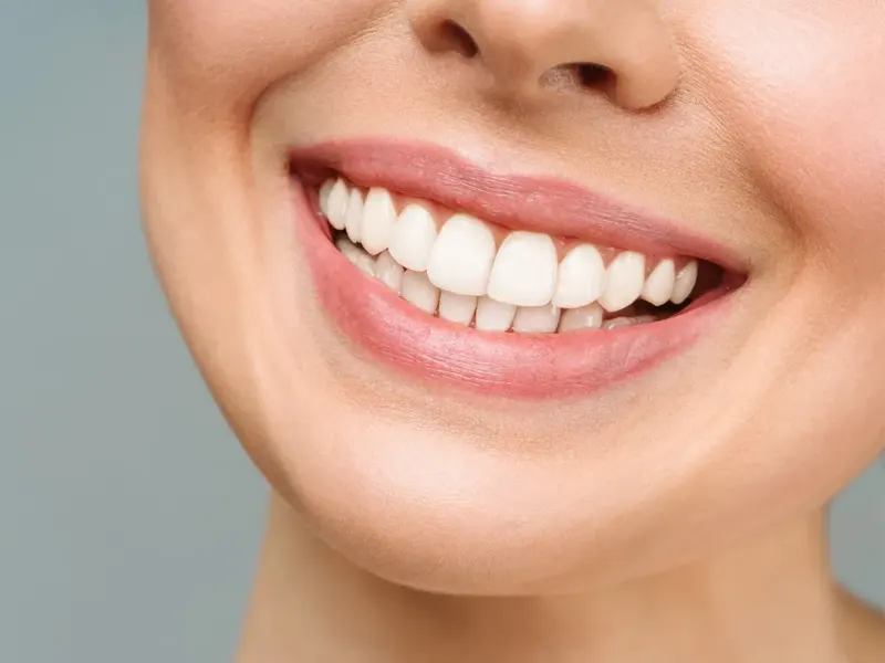 اصلاح طرح لبخند